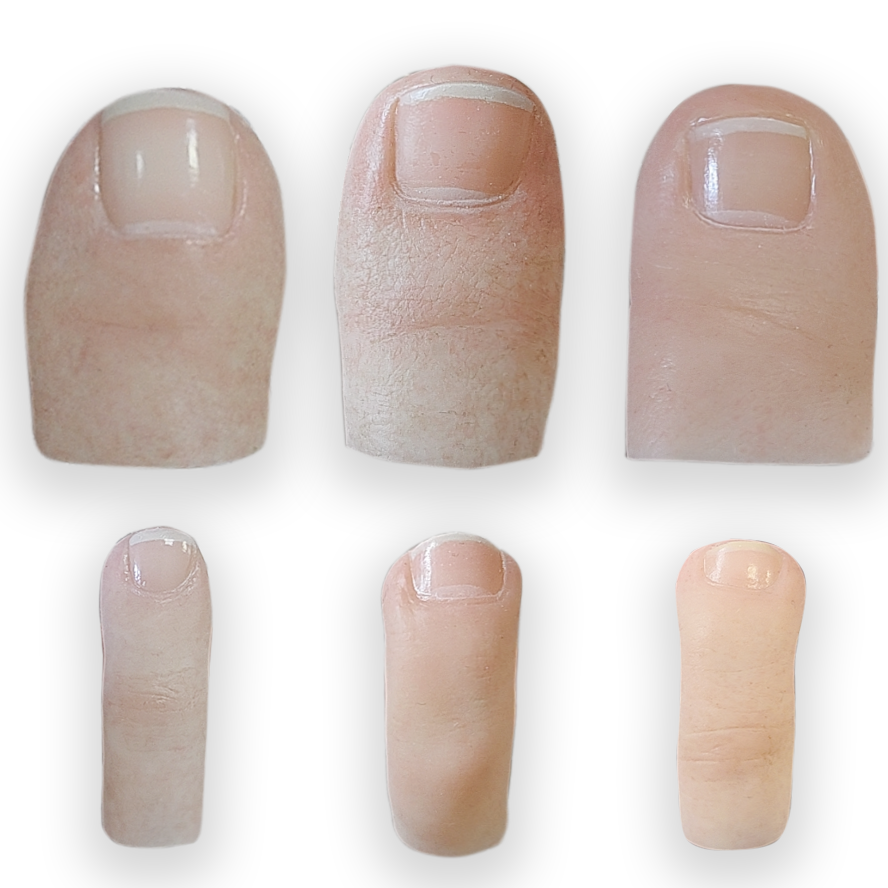 Custom Toe Prosthesis | Bio-inspired Medical-Grade Silicone Toe | 1:1 Precision Fit Based on Measurements | Multiple Skin Tone Options